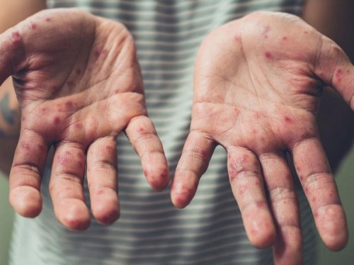 ������ ����������� ������� ���������� �������� �� ����