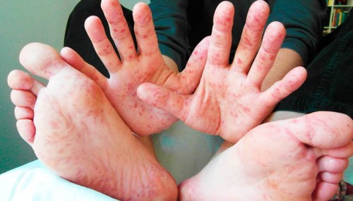 ������ ����������� ������� ������ ������ �����