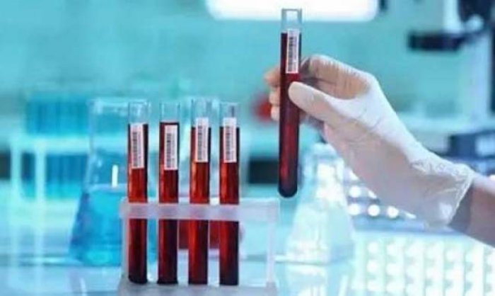 ������� ����� ����, �������� ��� ������ ����