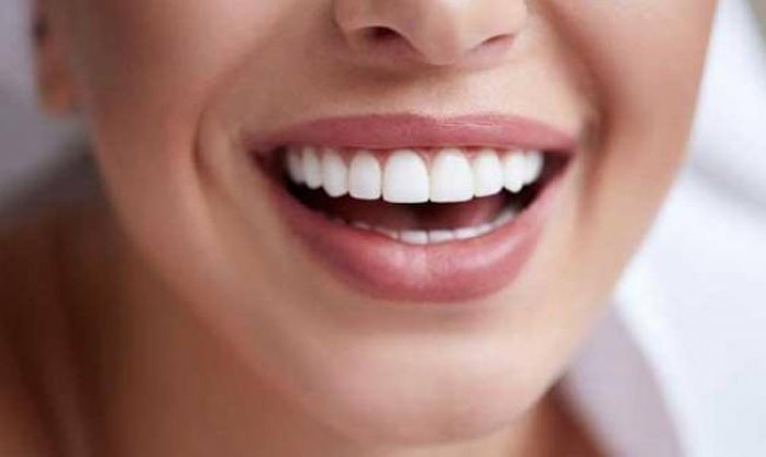 Композитные vs керамические виниры: что выбрать в 2026 году Композитные vs керамические виниры: что выбрать в 2026 году