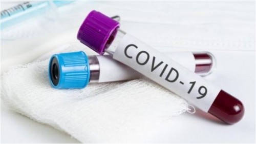      COVID-19:    