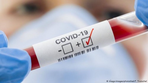 4    59 : COVID-19   
