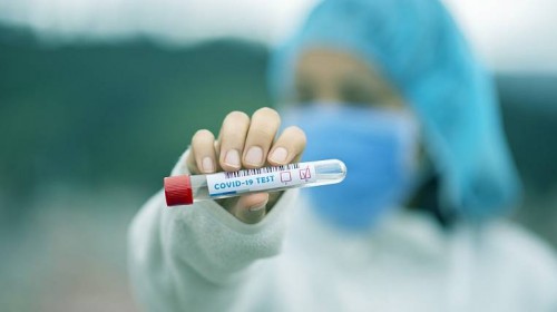 В Запорожской области выздоровевших от COVID-19 намного больше, чем заболевших: снимут ли ограничения